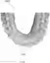 Fig. 18 - METHODS AND SYSTEMS FOR CREATING IMPROVED ORTHODONTIC ALIGNERS WITH TONGUE SPIKES