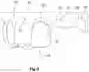 Fig. 04 - ARTIFICIAL TOOTH ELEMENT