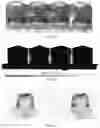 Fig. 13 - Systems and methods for personalized oral irrigation