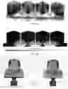 Fig. 15 - Systems and methods for personalized oral irrigation