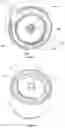 Fig. 07 - Dental debris separator