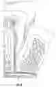 Fig. 05 - Subgingival medicament delivery tray