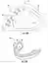 Fig. 18 - Subgingival medicament delivery tray