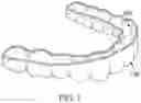 Fig. 02 - MEDICAMENT DELIVERY TOOTH COVERING