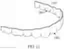 Fig. 11 - MEDICAMENT DELIVERY TOOTH COVERING