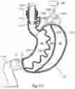 Fig. 18 - Artificial stomach