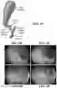 Fig. 06 - DEVICES, SYSTEMS, AND METHODS FOR TREATMENT OF DUCT OCCLUSION