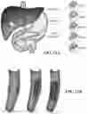 Fig. 16 - DEVICES, SYSTEMS, AND METHODS FOR TREATMENT OF DUCT OCCLUSION