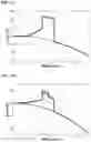 Fig. 12 - Intraocular lens