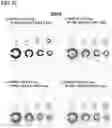 Fig. 21 - Intraocular lens