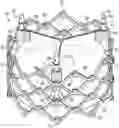 Fig. 01 - PROSTHETIC HEART VALVE HAVING NON-CYLINDRICAL FRAME