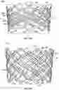 Fig. 14 - PROSTHETIC HEART VALVE HAVING NON-CYLINDRICAL FRAME