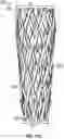 Fig. 15 - PROSTHETIC HEART VALVE HAVING NON-CYLINDRICAL FRAME