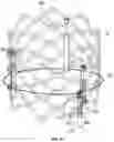 Fig. 26 - PROSTHETIC HEART VALVE HAVING NON-CYLINDRICAL FRAME