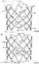 Fig. 30 - PROSTHETIC HEART VALVE HAVING NON-CYLINDRICAL FRAME