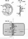 Fig. 03 - AN IMPLANTABLE DEVICE FOR REPAIRING A CARDIAC VALVE