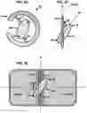Fig. 04 - AN IMPLANTABLE DEVICE FOR REPAIRING A CARDIAC VALVE