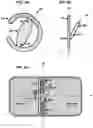 Fig. 07 - AN IMPLANTABLE DEVICE FOR REPAIRING A CARDIAC VALVE