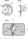 Fig. 08 - AN IMPLANTABLE DEVICE FOR REPAIRING A CARDIAC VALVE