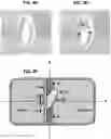 Fig. 10 - AN IMPLANTABLE DEVICE FOR REPAIRING A CARDIAC VALVE