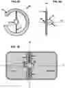 Fig. 11 - AN IMPLANTABLE DEVICE FOR REPAIRING A CARDIAC VALVE