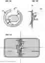 Fig. 13 - AN IMPLANTABLE DEVICE FOR REPAIRING A CARDIAC VALVE