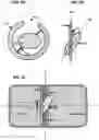 Fig. 14 - AN IMPLANTABLE DEVICE FOR REPAIRING A CARDIAC VALVE