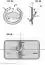 Fig. 17 - AN IMPLANTABLE DEVICE FOR REPAIRING A CARDIAC VALVE