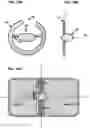 Fig. 19 - AN IMPLANTABLE DEVICE FOR REPAIRING A CARDIAC VALVE