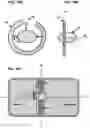 Fig. 20 - AN IMPLANTABLE DEVICE FOR REPAIRING A CARDIAC VALVE