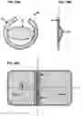 Fig. 33 - AN IMPLANTABLE DEVICE FOR REPAIRING A CARDIAC VALVE