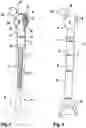Fig. 02 - MODULAR PROSTHESIS FOR AT LEAST PARTIAL REPLACEMENT OF A TUBULAR BONE ADJOINING A JOINT