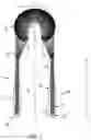 Fig. 02 - COMPOSITE IMPLANT FOR TOTAL MENISCUS RECONSTRUCTION