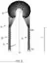 Fig. 04 - COMPOSITE IMPLANT FOR TOTAL MENISCUS RECONSTRUCTION