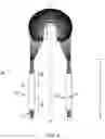 Fig. 05 - COMPOSITE IMPLANT FOR TOTAL MENISCUS RECONSTRUCTION