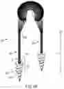 Fig. 07 - COMPOSITE IMPLANT FOR TOTAL MENISCUS RECONSTRUCTION