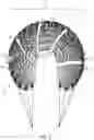 Fig. 10 - COMPOSITE IMPLANT FOR TOTAL MENISCUS RECONSTRUCTION