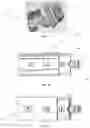 Fig. 05 - Systems and Methods for Manufacturing, Preparation and Use of Blanks in Orthopedic Implants