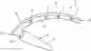Fig. 01 - Prosthesis for Movably Couplings os Metacarpale I of a Hand to a Second Metacarpal Bone and a Combination of a Prosthesis and a Fastening Means