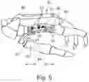 Fig. 04 - Prosthesis for Movably Couplings os Metacarpale I of a Hand to a Second Metacarpal Bone and a Combination of a Prosthesis and a Fastening Means