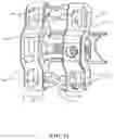 Fig. 10 - Interspinous implants
