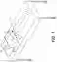 Fig. 02 - Coiling implantable prostheses and methods for implanting