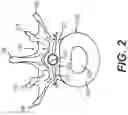 Fig. 03 - Coiling implantable prostheses and methods for implanting