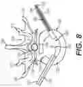 Fig. 10 - Coiling implantable prostheses and methods for implanting