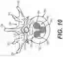 Fig. 12 - Coiling implantable prostheses and methods for implanting