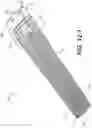 Fig. 14 - Coiling implantable prostheses and methods for implanting