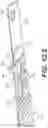 Fig. 21 - Coiling implantable prostheses and methods for implanting