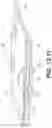 Fig. 23 - Coiling implantable prostheses and methods for implanting
