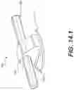 Fig. 26 - Coiling implantable prostheses and methods for implanting