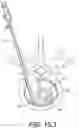 Fig. 31 - Coiling implantable prostheses and methods for implanting